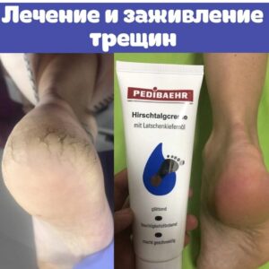 Крем для ніг зі 100% -вим оленячим жиром 500мл (DEER TALLOW CREAM), PEDIBAEHR